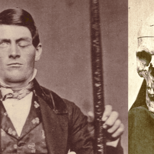 Phineas P. Gage